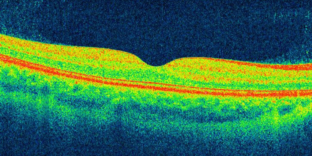 Live Imaging and Functional Evaluation (LIFE)